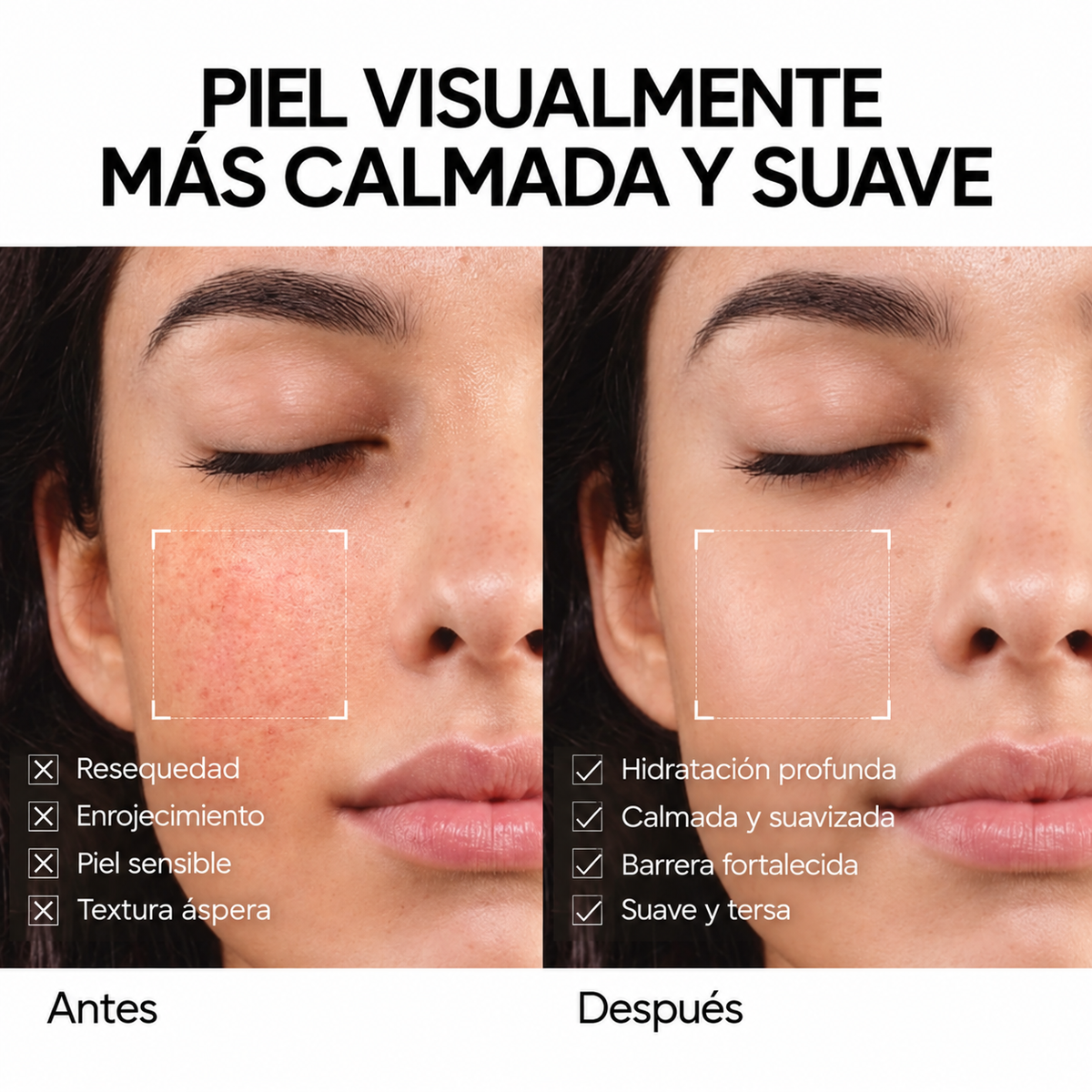 Gel Hidratante Reparador de la Barrera con 5X Ceramidas